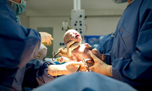 CAESAREAN FACILITIES