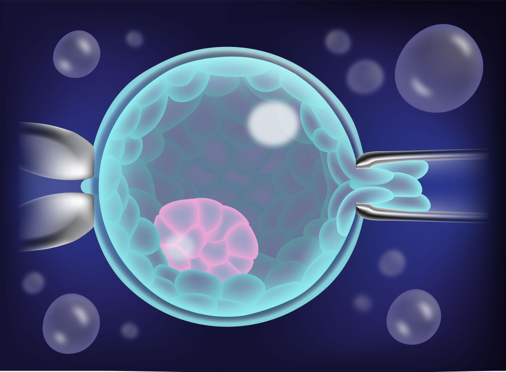 Embryo Biopsy