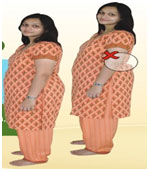 Physiotherapy Exercise