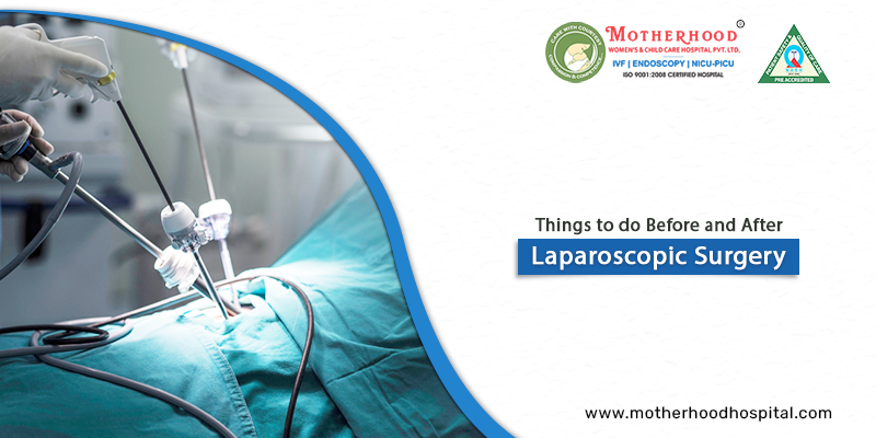 4 Important Things to do Before and After Undergoing a Laparoscopic Surgery